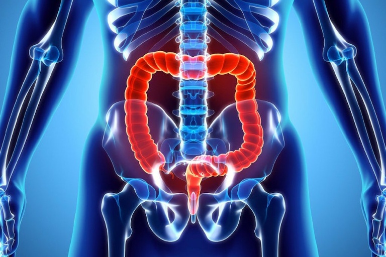 Bexiga e intestino neurogênico podem ganhar terapia pelo SUS