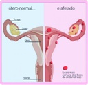 Dia 8 de maio pode ser dedicado à conscientização sobre endometriose 