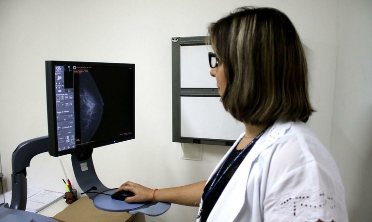 Divulgação do número de mamografias em Curitiba pode se tornar obrigatória
