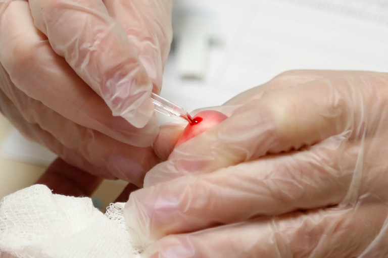 Saúde analisa medida de incentivo à doação de medula óssea