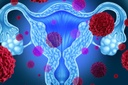 Tribuna Livre discute fertilidade de mulheres com câncer pélvico