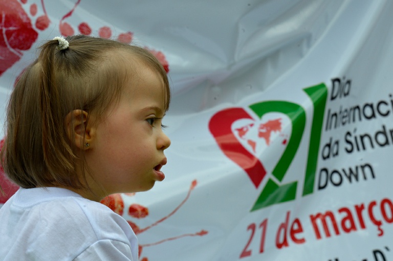 Vereadores votam projeto que reduz preconceito à síndrome de down 